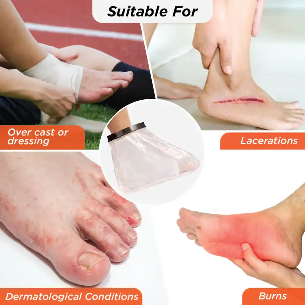 VISSCO Cast Cover - Leg
