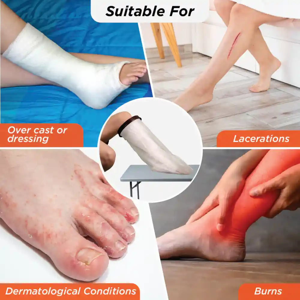 VISSCO Cast Cover - Leg