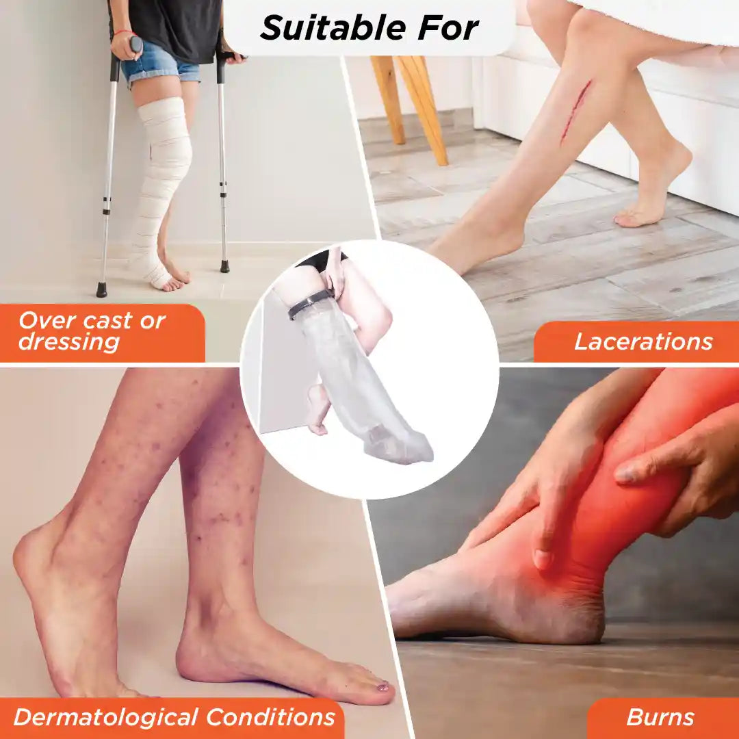 VISSCO Cast Cover - Thigh